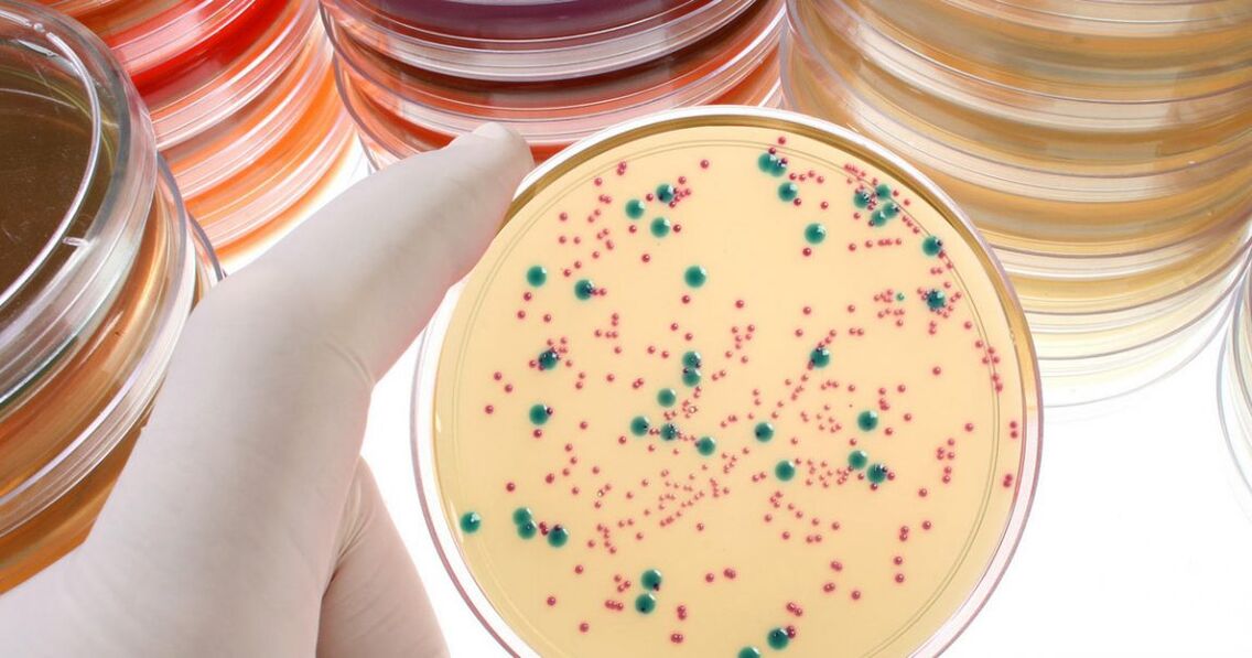 Prostatita cronică bacteriană este depistată prin analiza urinei și a secrețiilor prostatei