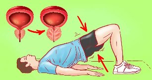 Exercițiu pentru prostatită