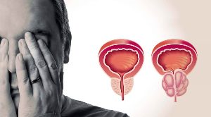 Prostata sanatoasa si inflamata