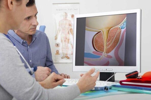 medicul consultă pacientul cu privire la problema prostatitei