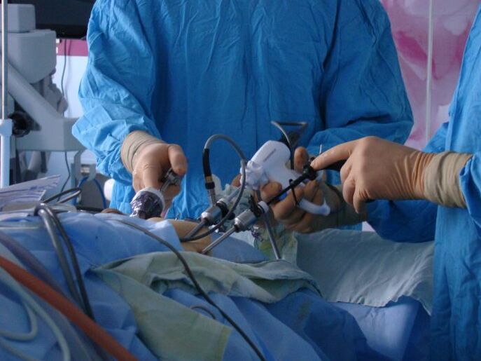 tratamentul chirurgical al prostatitei