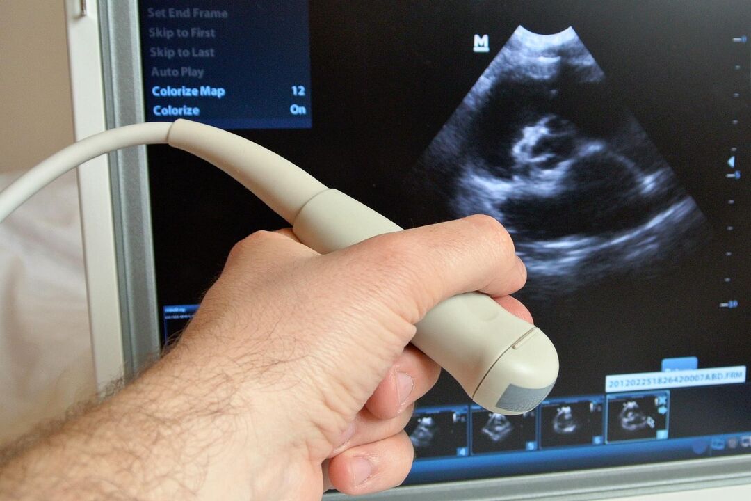 Ecografia va ajuta la diagnosticarea prostatitei congestive la un bărbat